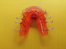 Невероятни Dental Implants 12
