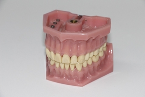 Изберете избелване на зъби 14