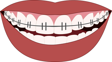 Разнообразие от избелване на зъби 20