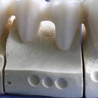 Нашият каталог с избелване на зъби цена 7