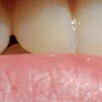Ефектни зъбни протези 12