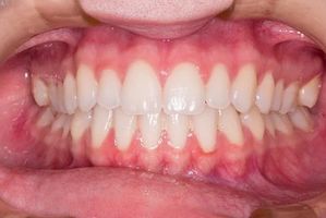 пасти за зъби без флуор - 66710 типа