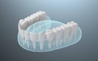 избелване на зъби цена - 85636 разновидности