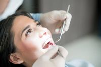 почистване на зъбен камък - 28773 клиенти