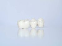 зъбни импланти - 17590 клиенти