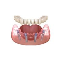 плазмолифтинг - 52845 варианти